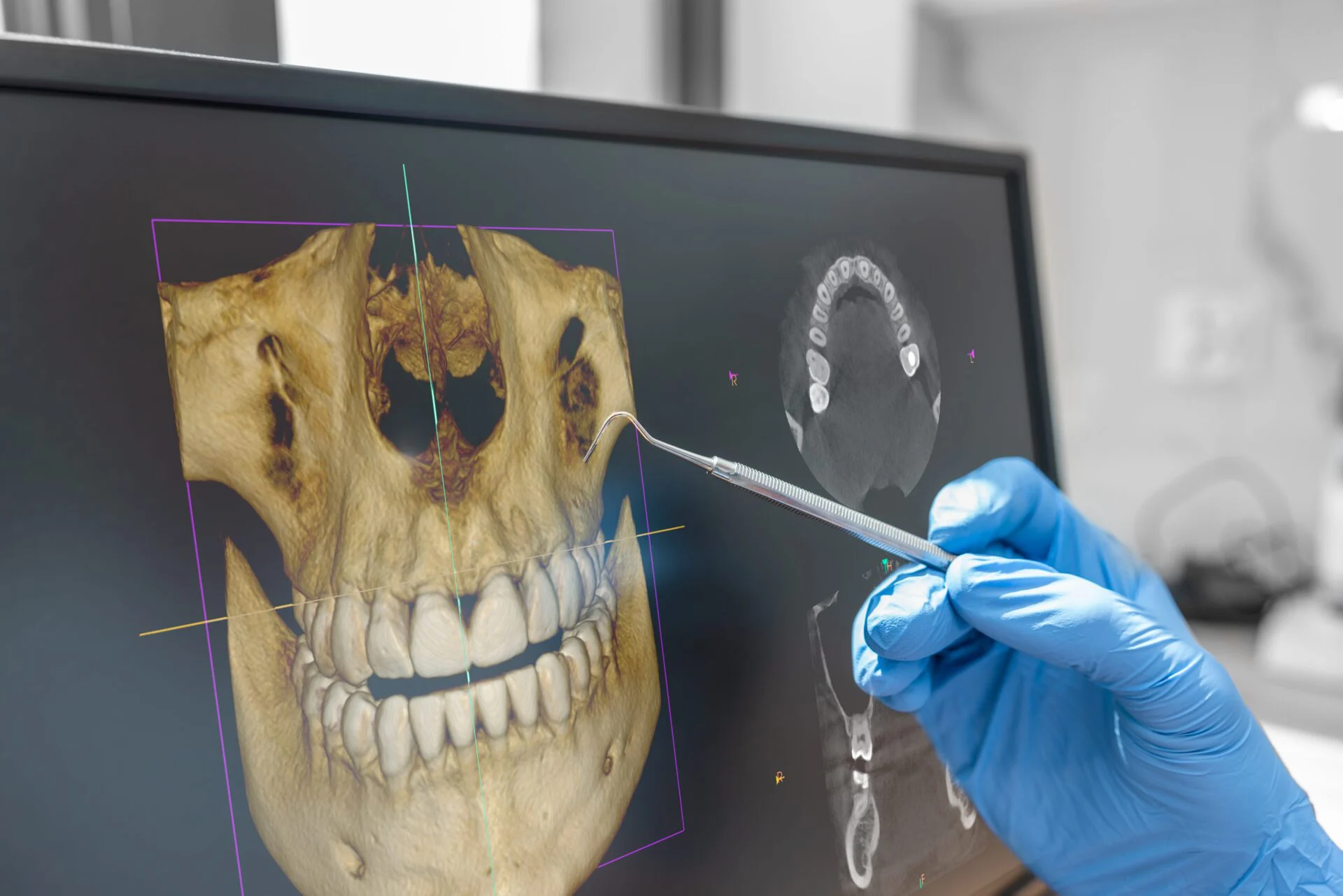 dental x-rays