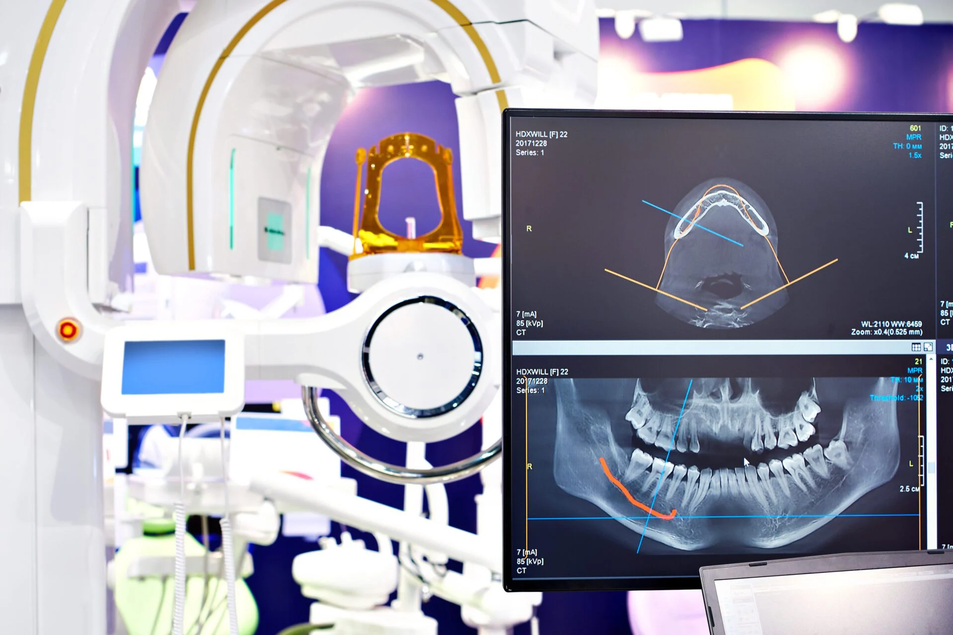 dental technology
